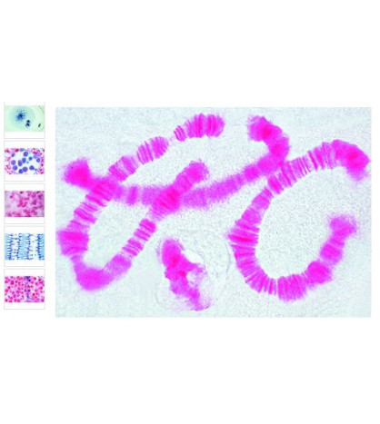 Mikroskopické preparáty -Mitóza a meióza, 6 preparátov
