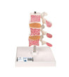 Model osteoporózy – 3 stavce v&nbsp;reze