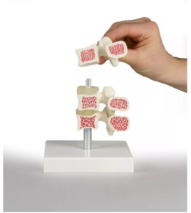 Model osteoporózy – 3 stavce v&nbsp;reze