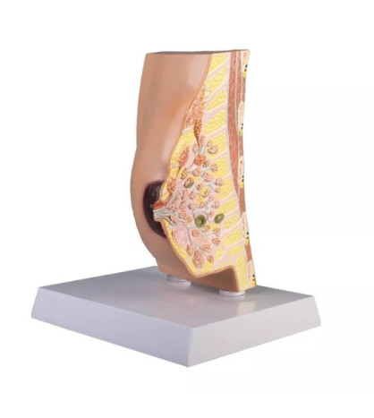 Model prierez prsníka s ochoreniami