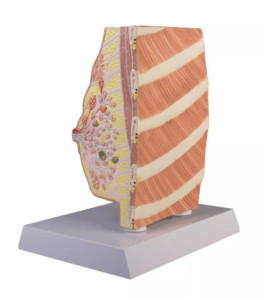 Model prierez prsníka s ochoreniami