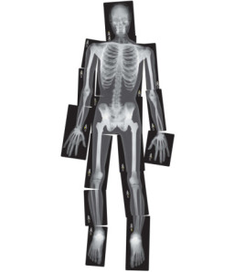 RTG snímky ľudskej kostry