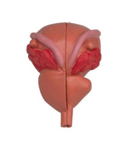 Model mužská prostata, 2-dielny model BPH
